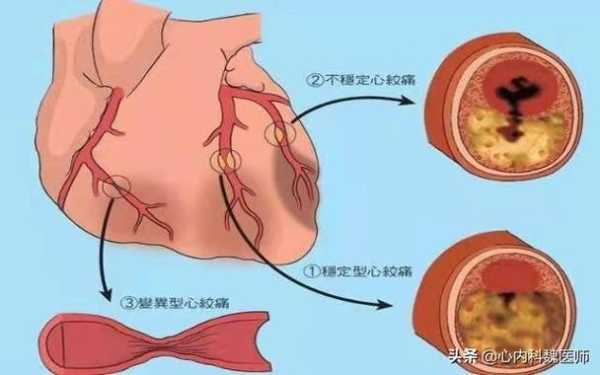 孕期心血管(孕妇心脏供血不足对胎儿有影响吗) 第1张 孕期心血管(孕妇心脏供血不足对胎儿有影响吗) 第1张