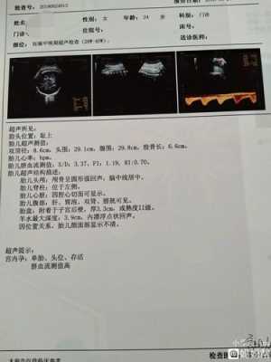孕十六周胎儿发育情况（孕16周羊水4.2是正常的吗?医生提醒要多喝水，会产生什么危害呢）  第1张