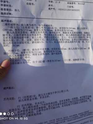 孕十六周胎儿发育情况（孕16周羊水4.2是正常的吗?医生提醒要多喝水，会产生什么危害呢）  第2张