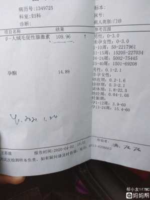 怀孕初期会双腿无力吗?孕期有什么症状是正常的呢,孕期血钾低的原因及危害 第1张 怀孕初期会双腿无力吗?孕期有什么症状是正常的呢,孕期血钾低的原因及危害 第1张