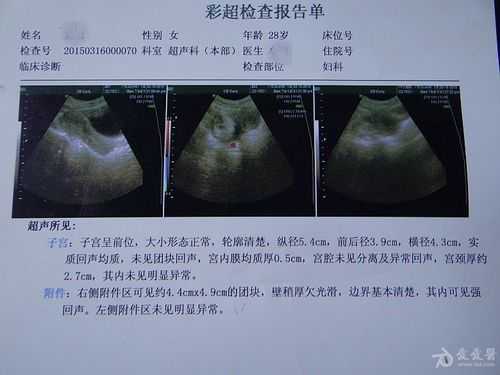 孕32周,彩超发现胎儿腹部有一个5×4.5的囊性团块,怎么办啊,孕32周胎儿彩超指标 第1张 孕32周,彩超发现胎儿腹部有一个5×4.5的囊性团块,怎么办啊,孕32周胎儿彩超指标 第1张
