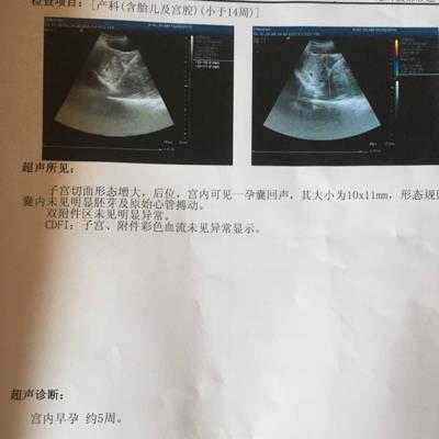 孕32周,彩超发现胎儿腹部有一个5×4.5的囊性团块,怎么办啊,孕32周胎儿彩超指标 第3张 孕32周,彩超发现胎儿腹部有一个5×4.5的囊性团块,怎么办啊,孕32周胎儿彩超指标 第3张