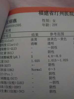 酸碱度7什么意思,孕期酸碱度7.0是男孩女孩? 第2张 酸碱度7什么意思,孕期酸碱度7.0是男孩女孩? 第2张