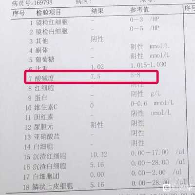 酸碱度7什么意思,孕期酸碱度7.0是男孩女孩? 第3张 酸碱度7什么意思,孕期酸碱度7.0是男孩女孩? 第3张
