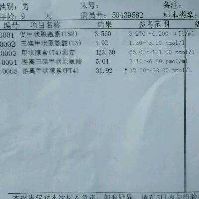 甲状腺素高对胎儿影响（甲状腺素高对胎儿影响大吗）  第2张
