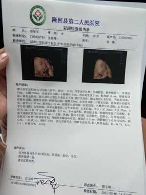 七个月胎儿有多重算是正常的呢,七个月胎儿彩超图片 第1张 七个月胎儿有多重算是正常的呢,七个月胎儿彩超图片 第1张