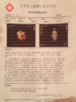 胎儿后颅窝池正常值(胎儿后颅窝池正常值) 第1张 胎儿后颅窝池正常值(胎儿后颅窝池正常值) 第1张