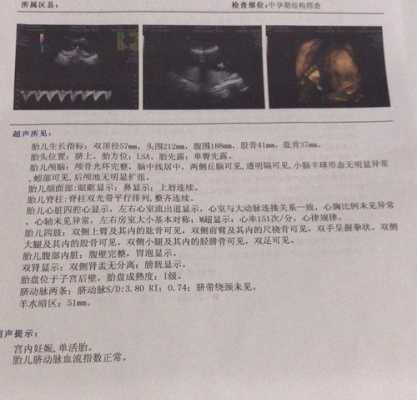 24周胎儿有多大,24周胎儿四维彩超数据标准值 第2张 24周胎儿有多大,24周胎儿四维彩超数据标准值 第2张
