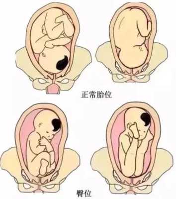 怀孕八个月女胎儿图(怀孕八个月臀位胎儿还会下降吗) 第2张 怀孕八个月女胎儿图(怀孕八个月臀位胎儿还会下降吗) 第2张