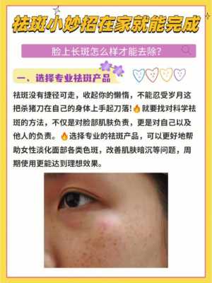 孕期祛斑小妙招(孕期祛斑小妙招有哪些) 第1张 孕期祛斑小妙招(孕期祛斑小妙招有哪些) 第1张