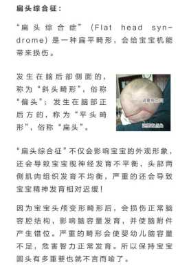 睡平头正确方法,胎儿头朝左是男孩女孩 第3张 睡平头正确方法,胎儿头朝左是男孩女孩 第3张