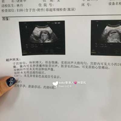 怀孕期间做了ct(怀孕期间做了ct) 第2张 怀孕期间做了ct(怀孕期间做了ct) 第2张