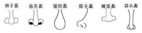 胎儿鼻低平(狮子鼻和猪鼻子区别) 第2张 胎儿鼻低平(狮子鼻和猪鼻子区别) 第2张