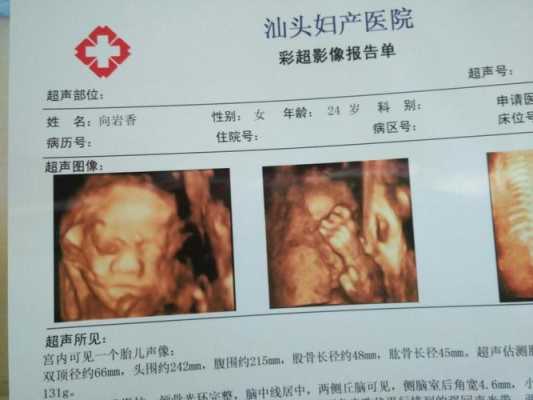 胎儿下巴小(胎儿下巴小会出现什么后果) 第3张 胎儿下巴小(胎儿下巴小会出现什么后果) 第3张