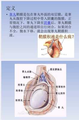 婴儿为什么有睾丸积液怎么治疗需要注意啥,胎儿睾丸积液问题大吗 第1张 婴儿为什么有睾丸积液怎么治疗需要注意啥,胎儿睾丸积液问题大吗 第1张