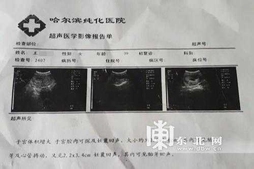 孕期b超检查结果（孕早期b超ut是什么？能看出什么呢）  第1张