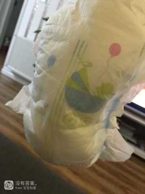 胎儿的尿泡(一个月大的宝宝冬天用什么尿不湿好) 第2张 胎儿的尿泡(一个月大的宝宝冬天用什么尿不湿好) 第2张