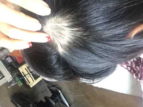 怀孕期间掉发(怀孕期间掉发严重是什么原因) 第3张 怀孕期间掉发(怀孕期间掉发严重是什么原因) 第3张