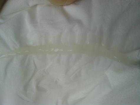 怀孕期间水样白带(怀孕六个月有水样白带,平时分泌物发黄怎么办) 第1张 怀孕期间水样白带(怀孕六个月有水样白带,平时分泌物发黄怎么办) 第1张