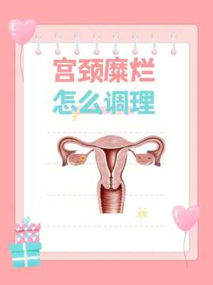 孕期如何治疗宫颈糜烂(孕期如何治疗宫颈糜烂呢) 第1张 孕期如何治疗宫颈糜烂(孕期如何治疗宫颈糜烂呢) 第1张