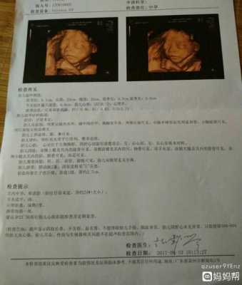 孕期几周做四维(孕期几周做四维彩超最好) 第2张 孕期几周做四维(孕期几周做四维彩超最好) 第2张