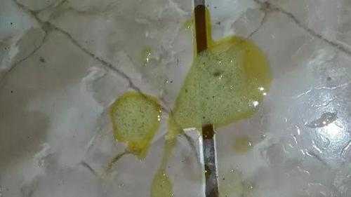 孕期流绿色分泌物(呕吐物为绿色液体什么状况) 第1张 孕期流绿色分泌物(呕吐物为绿色液体什么状况) 第1张