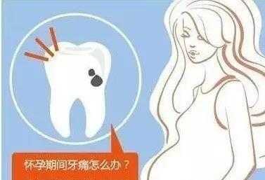 如果孕妇经常会牙痛,会影响到胎儿吗,孕期牙疼对胎儿的影响有哪些 第3张 如果孕妇经常会牙痛,会影响到胎儿吗,孕期牙疼对胎儿的影响有哪些 第3张