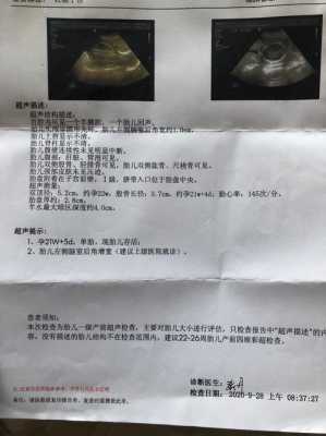 胎儿cm增宽（胎儿增宽1.1厘米）  第2张