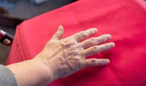 孕晚期右手指尖麻,正常吗?以前都是晚上睡觉时会麻,怀孕期间右手麻木是什么原因 第2张 孕晚期右手指尖麻,正常吗?以前都是晚上睡觉时会麻,怀孕期间右手麻木是什么原因 第2张