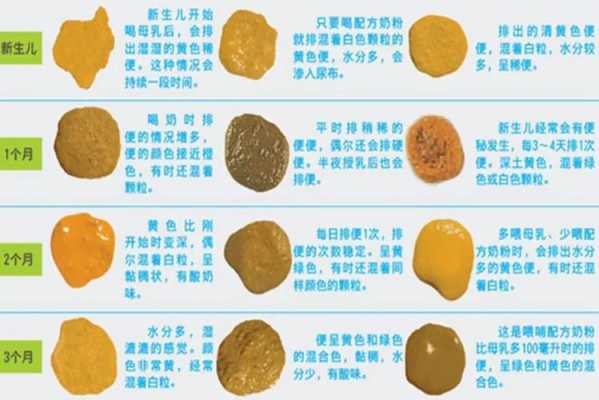 胎儿在肚子大便(胎儿在肚子大便吗) 第2张 胎儿在肚子大便(胎儿在肚子大便吗) 第2张