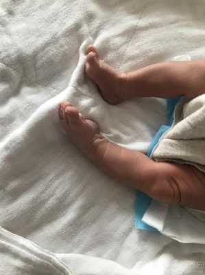 胎儿右脚内翻(新生儿轻微脚内翻是怎么回事呢) 第1张 胎儿右脚内翻(新生儿轻微脚内翻是怎么回事呢) 第1张