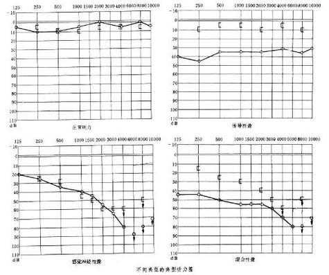 怎么测胎儿听力(胎儿几个月有听力) 第3张 怎么测胎儿听力(胎儿几个月有听力) 第3张