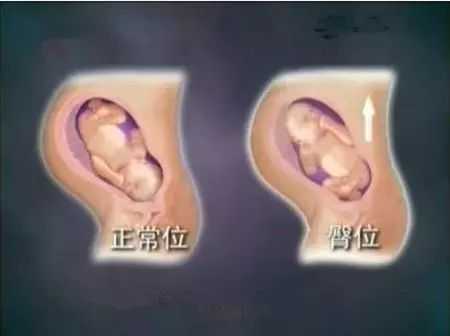 28周的宝宝在肚子哪个位置,28周胎儿位置低怎么办 第1张 28周的宝宝在肚子哪个位置,28周胎儿位置低怎么办 第1张