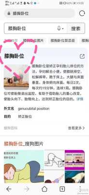 胎儿臀卧位(胎儿臀位采取什么卧位) 第2张 胎儿臀卧位(胎儿臀位采取什么卧位) 第2张