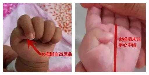 胎儿手的发育(婴儿手不握拳正常吗?在什么时候小宝宝能正常握拳) 第1张 胎儿手的发育(婴儿手不握拳正常吗?在什么时候小宝宝能正常握拳) 第1张
