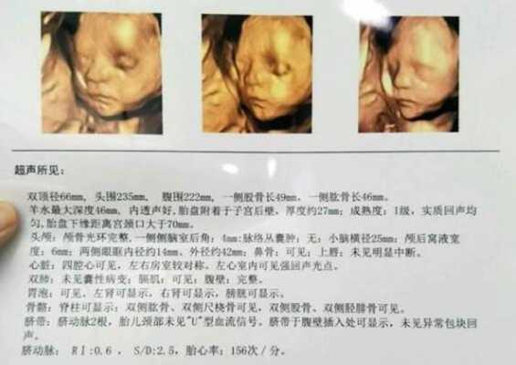 整个孕期要做几次四维彩超?一般只做1次就可以吗,怀孕期间做几次检查最好 第1张 整个孕期要做几次四维彩超?一般只做1次就可以吗,怀孕期间做几次检查最好 第1张