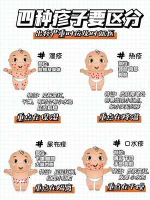 孕期湿疹产后怎么办啊(孕期湿疹产后怎么办啊) 第1张 孕期湿疹产后怎么办啊(孕期湿疹产后怎么办啊) 第1张