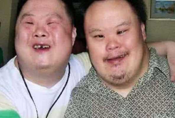怀唐氏儿的孕妇有什么症状,唐氏儿孕妇回忆孕期症状贴吧 第2张 怀唐氏儿的孕妇有什么症状,唐氏儿孕妇回忆孕期症状贴吧 第2张