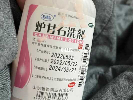 孕期湿疹是怎么回事啊(怀孕湿疹是怎么引起的吗?孕妇湿疹可以用什么药吗) 第3张 孕期湿疹是怎么回事啊(怀孕湿疹是怎么引起的吗?孕妇湿疹可以用什么药吗) 第3张