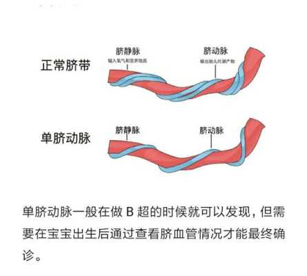 孕12周了检查宝宝是单脐动脉是怎么回事,胎儿有几条脐动脉和脐静脉 第3张 孕12周了检查宝宝是单脐动脉是怎么回事,胎儿有几条脐动脉和脐静脉 第3张