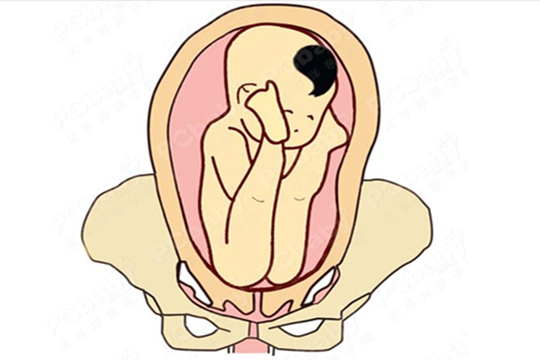 怀孕30周胎儿发育情况(孕30周胎儿臀位还能自己转过来吗) 第2张 怀孕30周胎儿发育情况(孕30周胎儿臀位还能自己转过来吗) 第2张