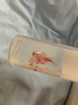 做胎儿绒毛怎么做(胚胎绒毛染色体检查有必要做吗) 第1张 做胎儿绒毛怎么做(胚胎绒毛染色体检查有必要做吗) 第1张