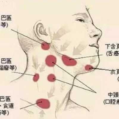 淋巴结肿大是怎么回事,淋巴结肿大的原因有哪些,怀孕期间淋巴结肿大怎么办 第1张 淋巴结肿大是怎么回事,淋巴结肿大的原因有哪些,怀孕期间淋巴结肿大怎么办 第1张