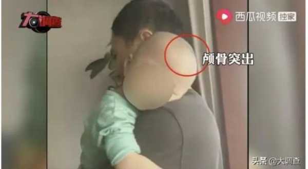 为什么我家宝宝会头大身子小?是什么原因啊,胎儿头大是怎么回事呢 第1张 为什么我家宝宝会头大身子小?是什么原因啊,胎儿头大是怎么回事呢 第1张