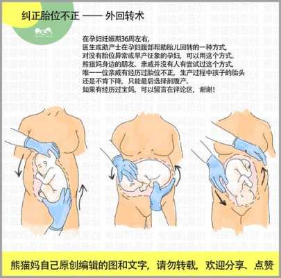胎儿胎位不正怎么办(36周,胎位不正怎么办) 第2张 胎儿胎位不正怎么办(36周,胎位不正怎么办) 第2张