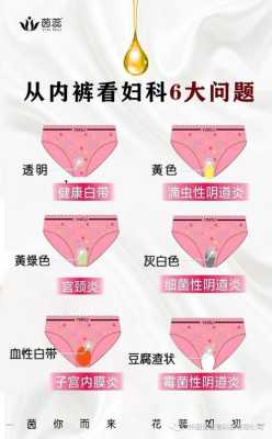孕期细菌性阴炎怎么办(细菌阴道炎要怎么治) 第1张 孕期细菌性阴炎怎么办(细菌阴道炎要怎么治) 第1张
