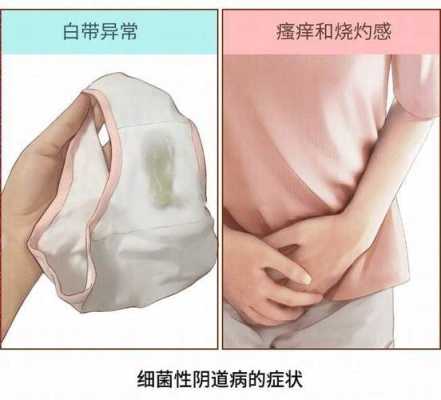 孕期细菌性阴炎怎么办(细菌阴道炎要怎么治) 第2张 孕期细菌性阴炎怎么办(细菌阴道炎要怎么治) 第2张