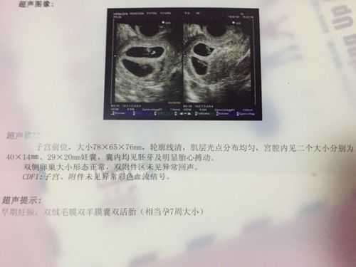 胎儿胎囊会萎缩吗(孕囊大胎芽小正常吗) 第2张 胎儿胎囊会萎缩吗(孕囊大胎芽小正常吗) 第2张