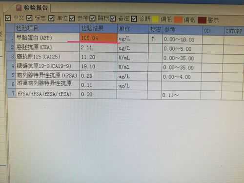 甲胎蛋白多少是肝癌,孕期甲胎蛋白正常值是多少? 第2张 甲胎蛋白多少是肝癌,孕期甲胎蛋白正常值是多少? 第2张