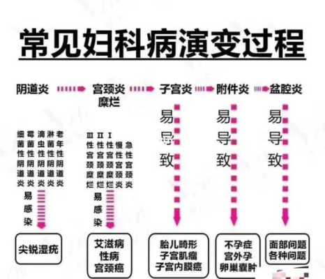 孕妇得了霉菌性阴炎怎么办,怀孕期间霉菌性阴炎怎么治疗 第2张 孕妇得了霉菌性阴炎怎么办,怀孕期间霉菌性阴炎怎么治疗 第2张